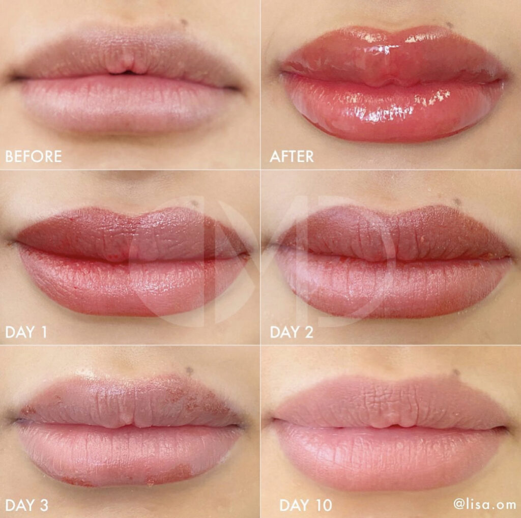 Ultimate Lily kontrast Lip Blush Aftercare Instructions | LISA OM