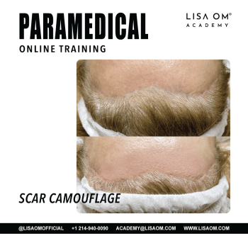 Online Scar Camouflage Training Course