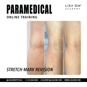 Online Inkless & Ink Stretch Marks Training Course